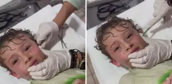 'Kafamın içinde bir şey kıpırdıyor' diyen çocuğun kulağından yengeç çıktı
