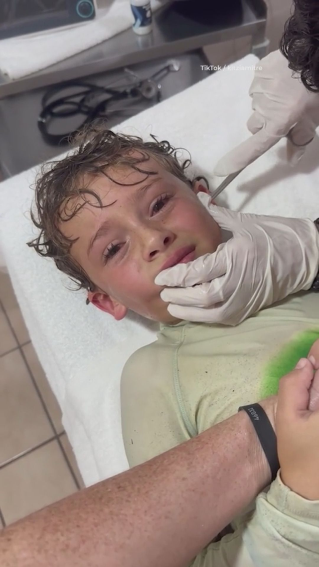 A crab was extracted from the ear of a child who said something was moving in his head