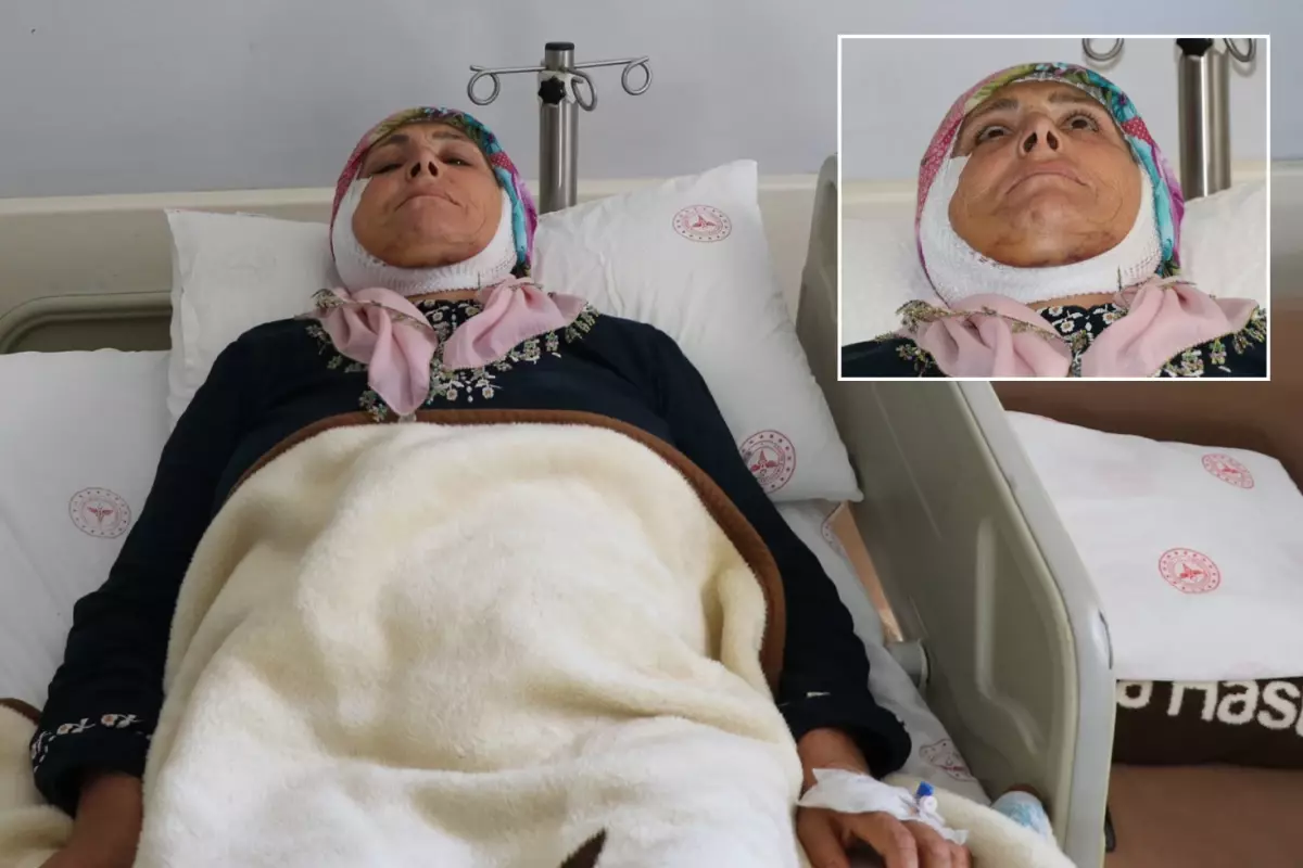 Tek ameliyatla sağlığına kavuştu, 15 yıl sonra ilk defa gülümseyebilecek