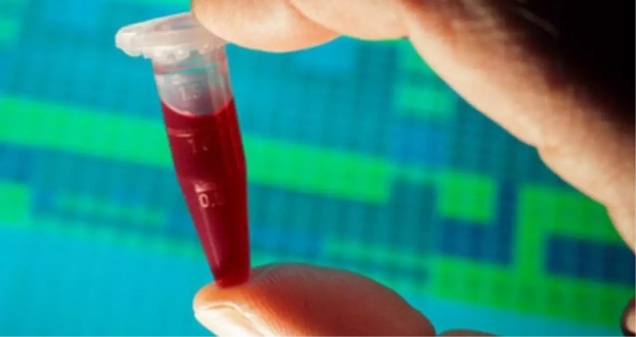 Altın kan grubu nedir? Altın kan grubu Türkiye'de var mı, dünyada kaç kişide var?