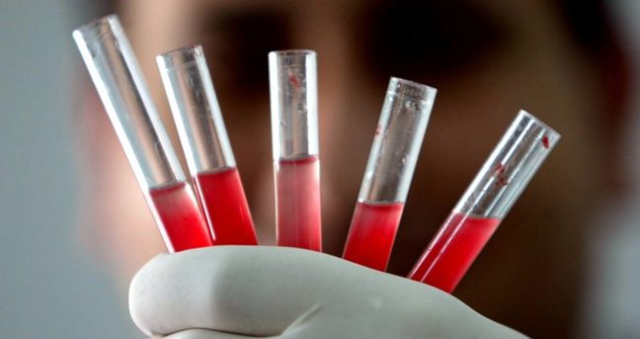 Altın kan grubu nedir? Altın kan grubu Türkiye'de var mı, dünyada kaç kişide var?