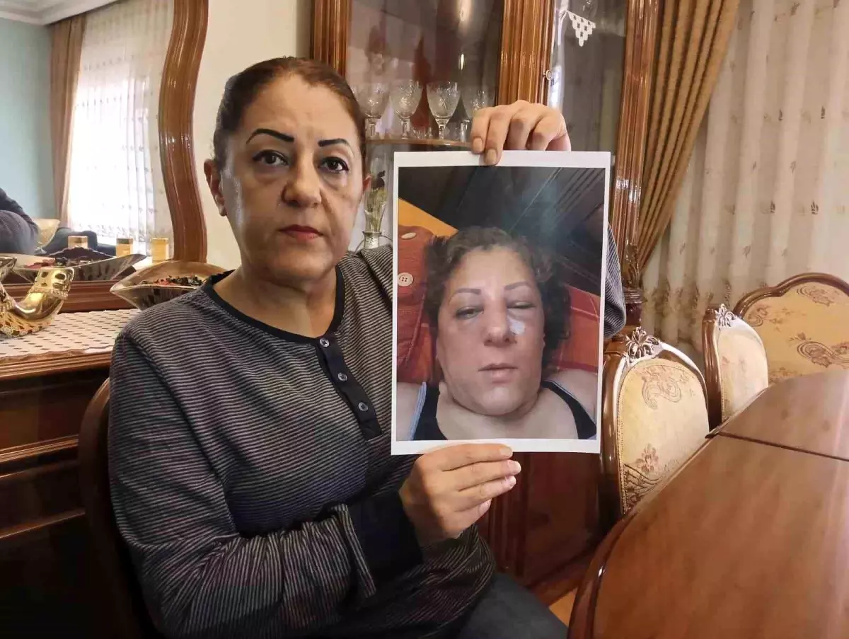 Ankara'da Komşu Kavgası: Kadına Saldırı, Burnu Kırıldı