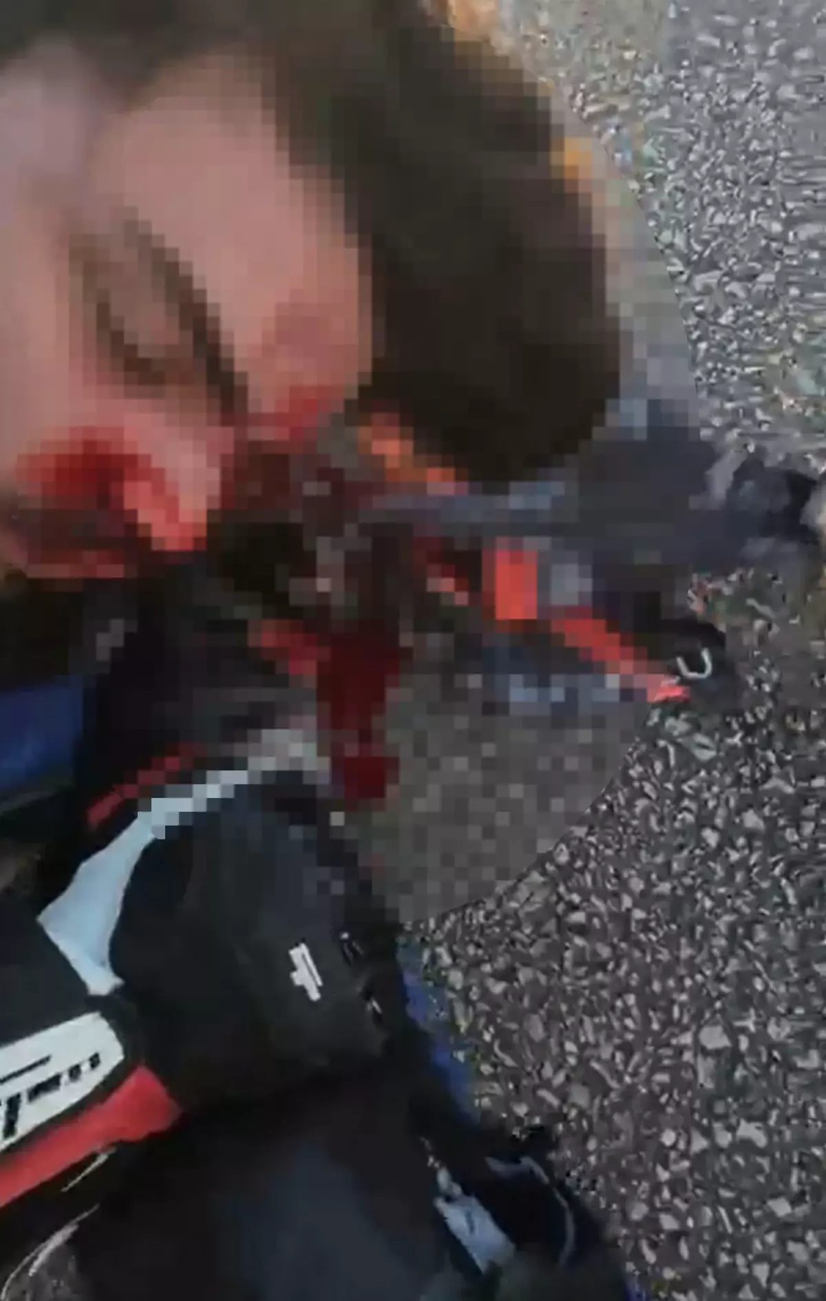 Çanakkale'de Motosiklet Kazası: Genç Sürücü Ağır Yaralı