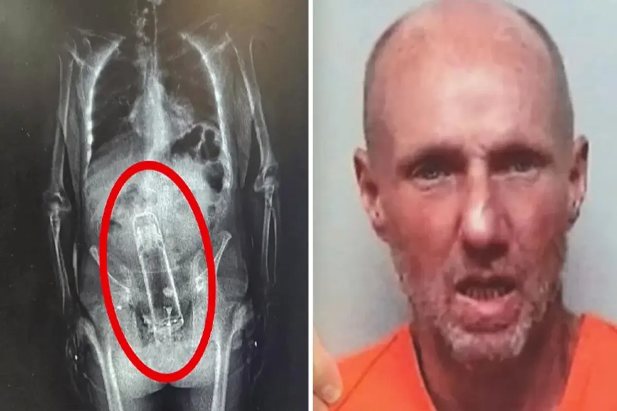 Hapishane girişinde fark edildi! X-Ray'de ortaya çıkan gerçek polislerin ağzını açık bıraktı