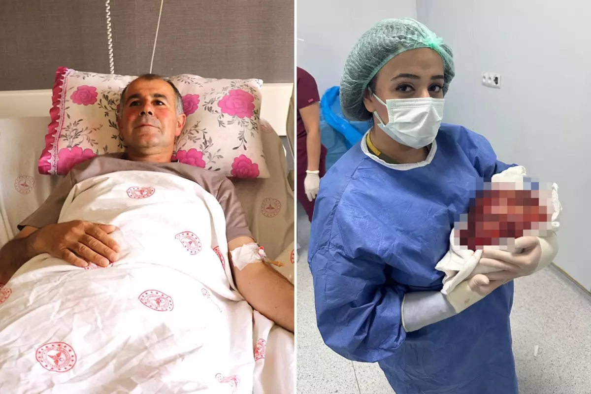 Şişkinlik şikayetiyle hastaneye başvurdu, karnından çıkan şoke etti