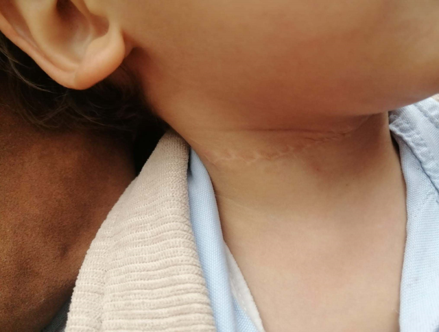 The only moment the defendant who cut the child's throat does not remember