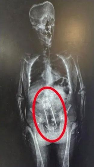 The discovery made during the search at the prison entrance shocked the police