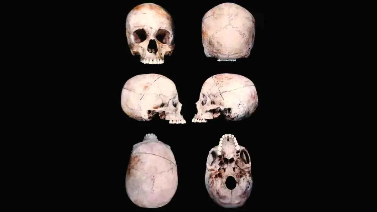 Diyarbakır'da 10 Yıl Sonra Cesedin Kimliği Belirlendi