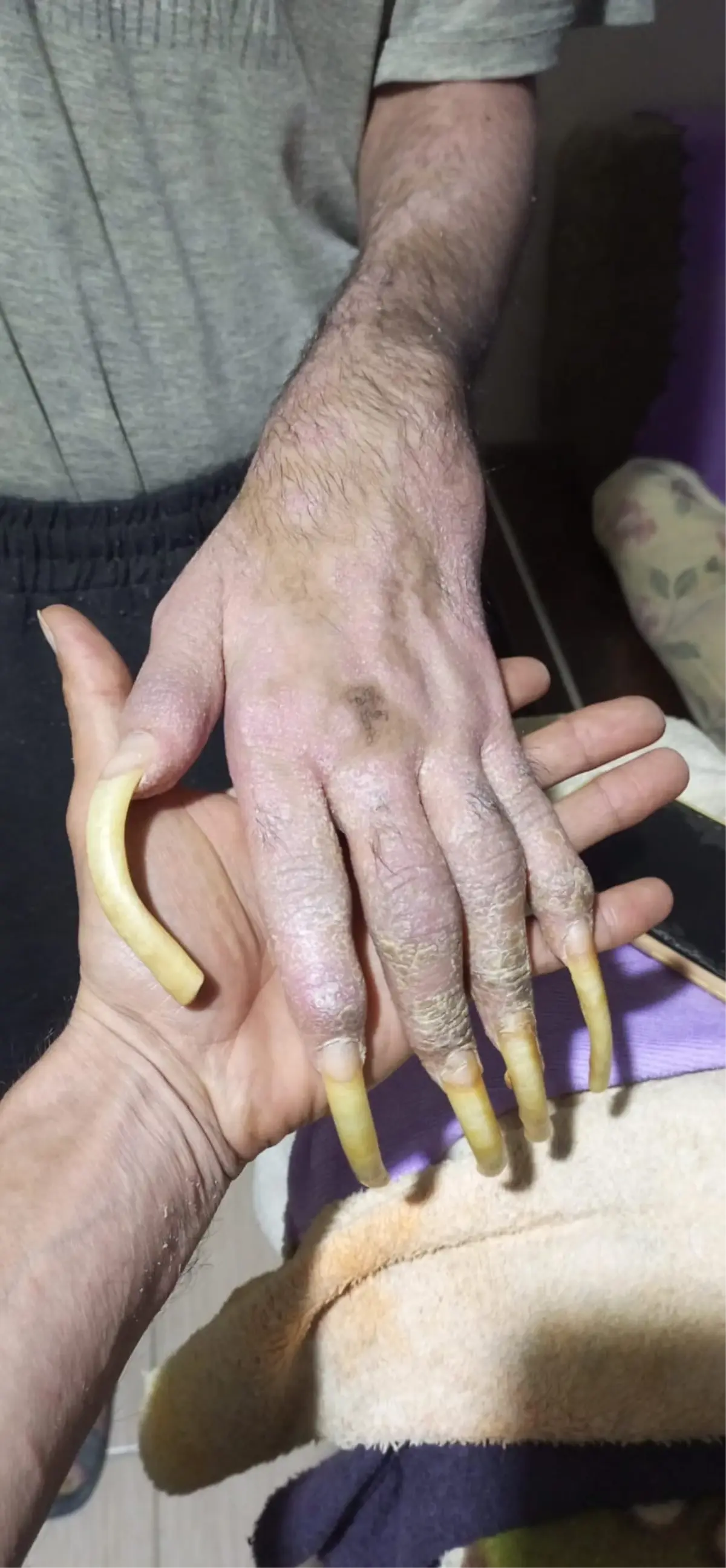 Telefon bağımlısı genç: 3 yıldır evden dışarı ne tek bir adım attı ne de beslenmek dışında bir şey yaptı