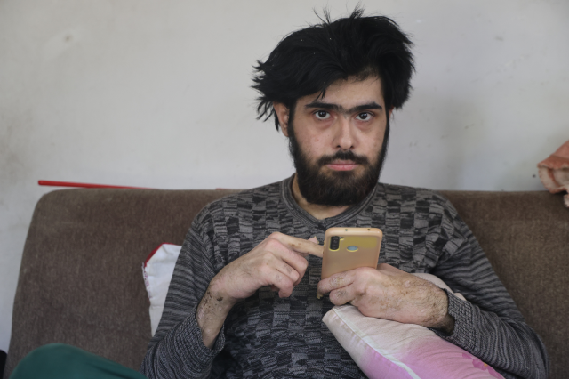 3 yildir tirnaklarini kesmeyen ve dus almayan 19152471 339 m