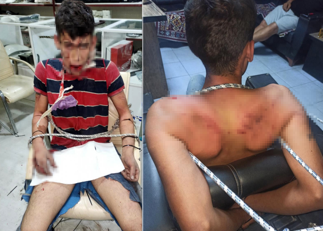 They broke his teeth and forced him to eat cockroaches in a locked warehouse! Here is the requested punishment