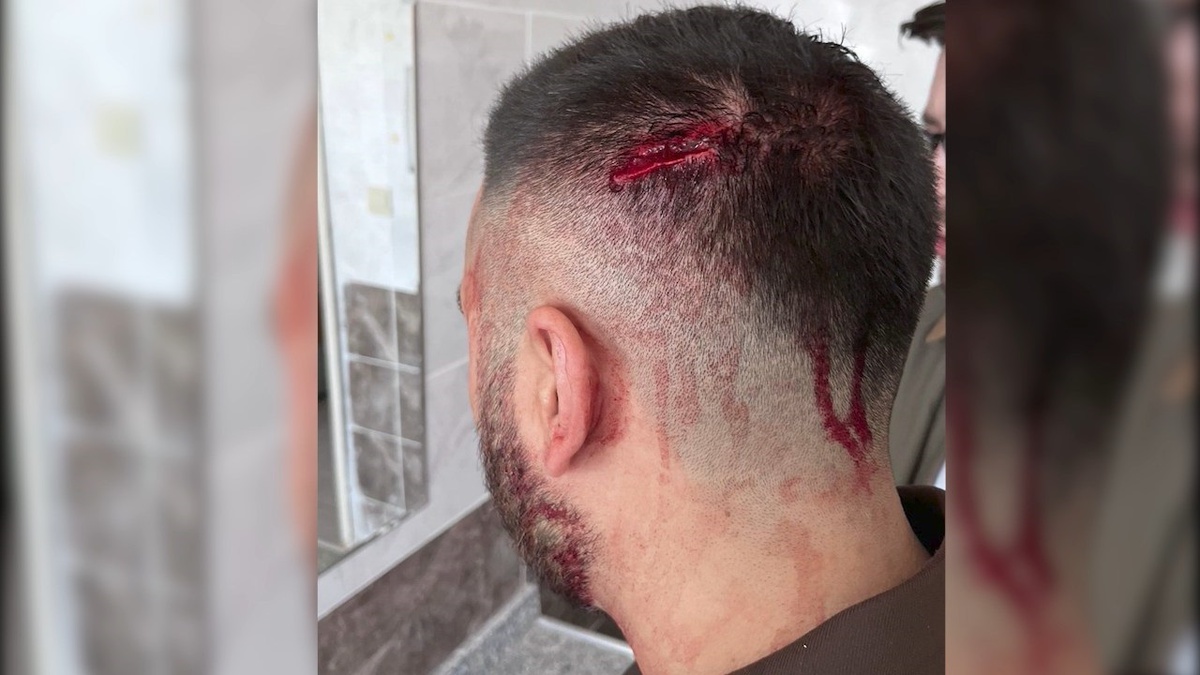 Öğretmene Demir Sopalı Saldırı: Şanlıurfa'da Acı Olay