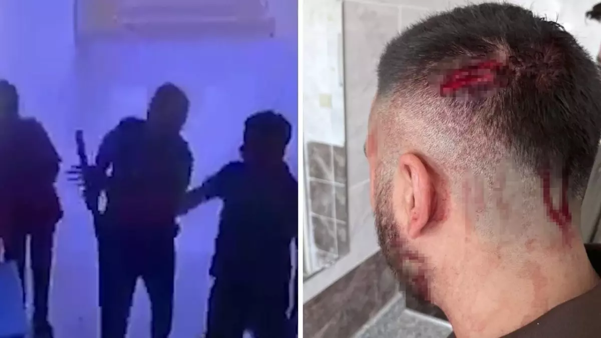 Öğretmene veliden sopalı saldırı