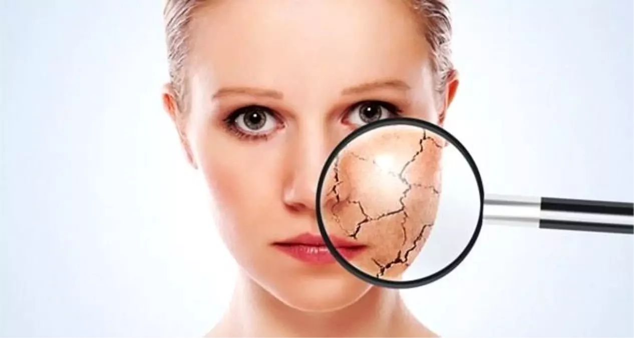 Kış Aylarında Cilt Bakımı: Mezoterapinin Faydaları