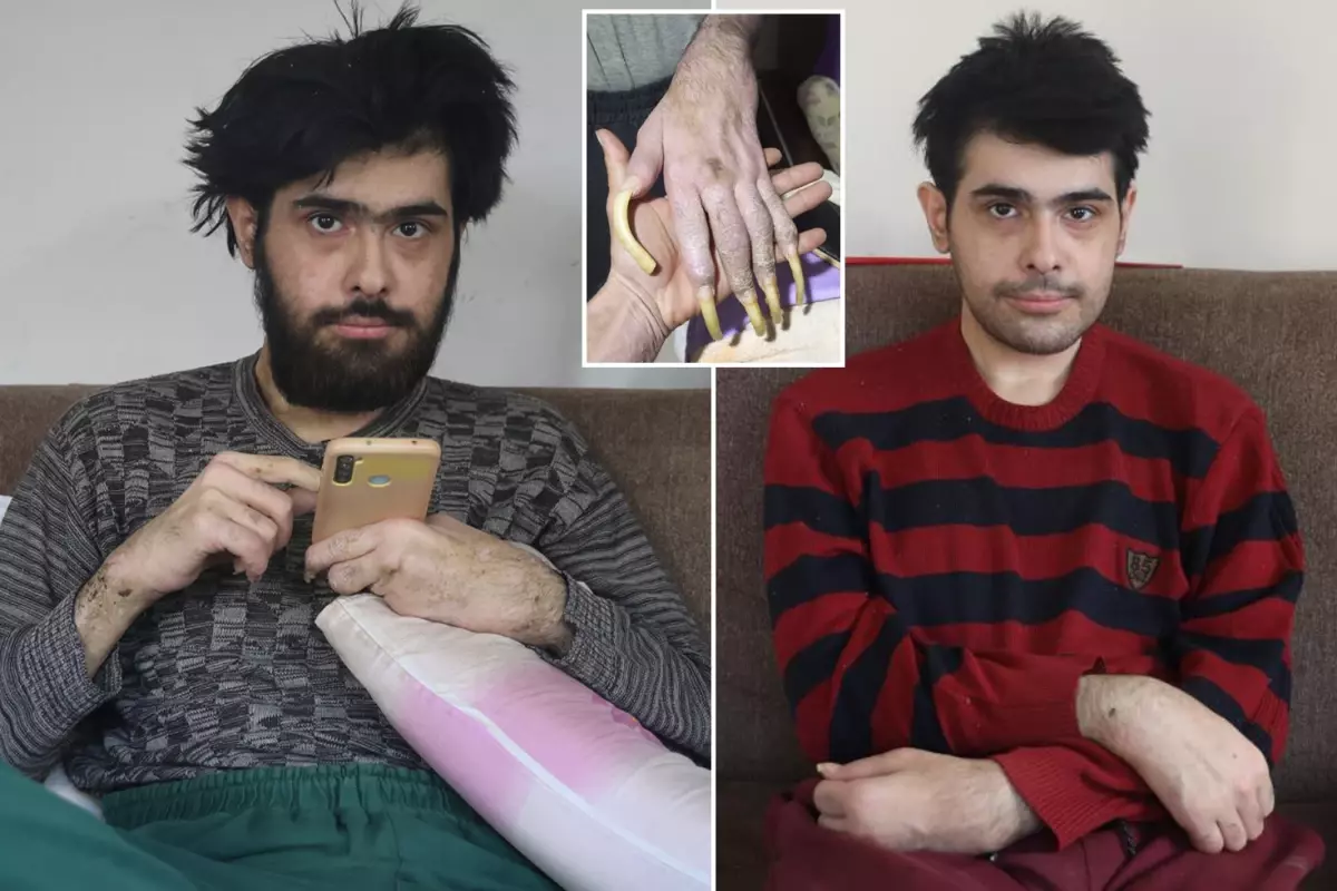 Telefon bağımlısı gençten ailelere tavsiye: Küçükken çocuklara telefon vermeyin