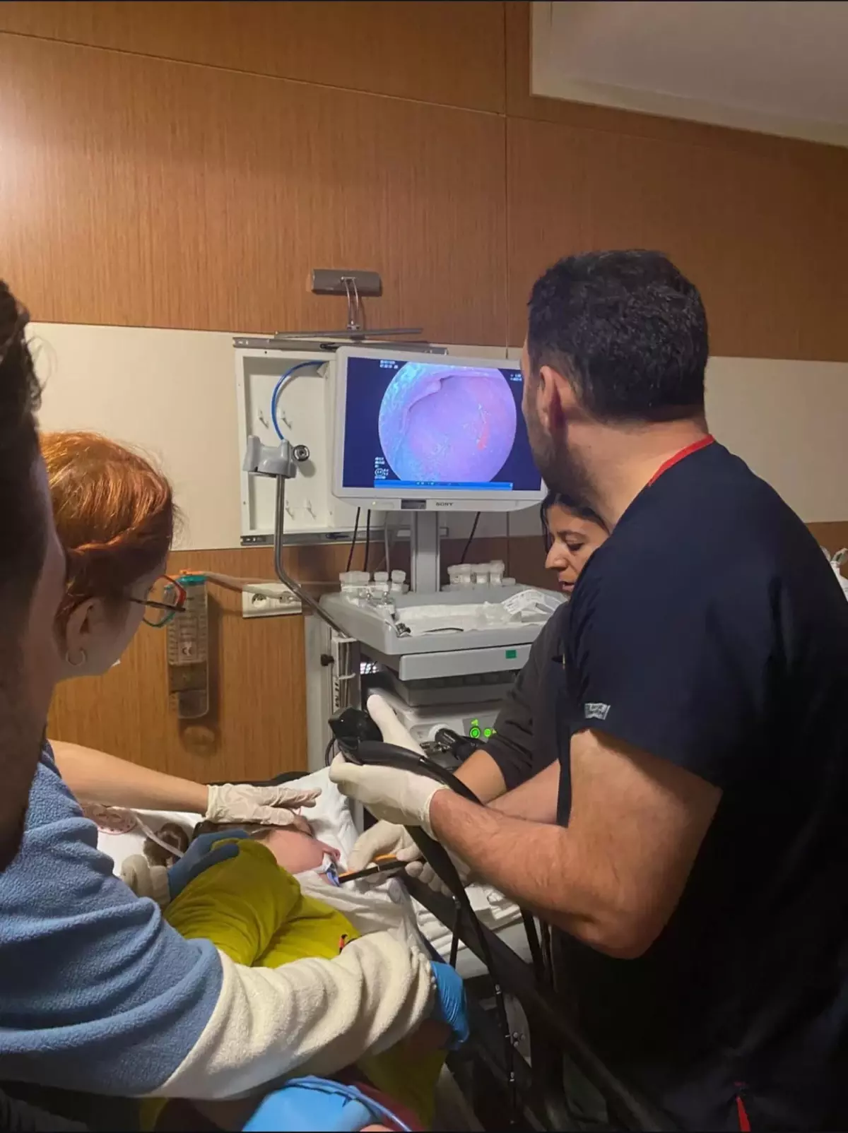 Zihinsel Engelli Kadının Yemek Borusuna Kaçan Ceviz Başarıyla Çıkarıldı