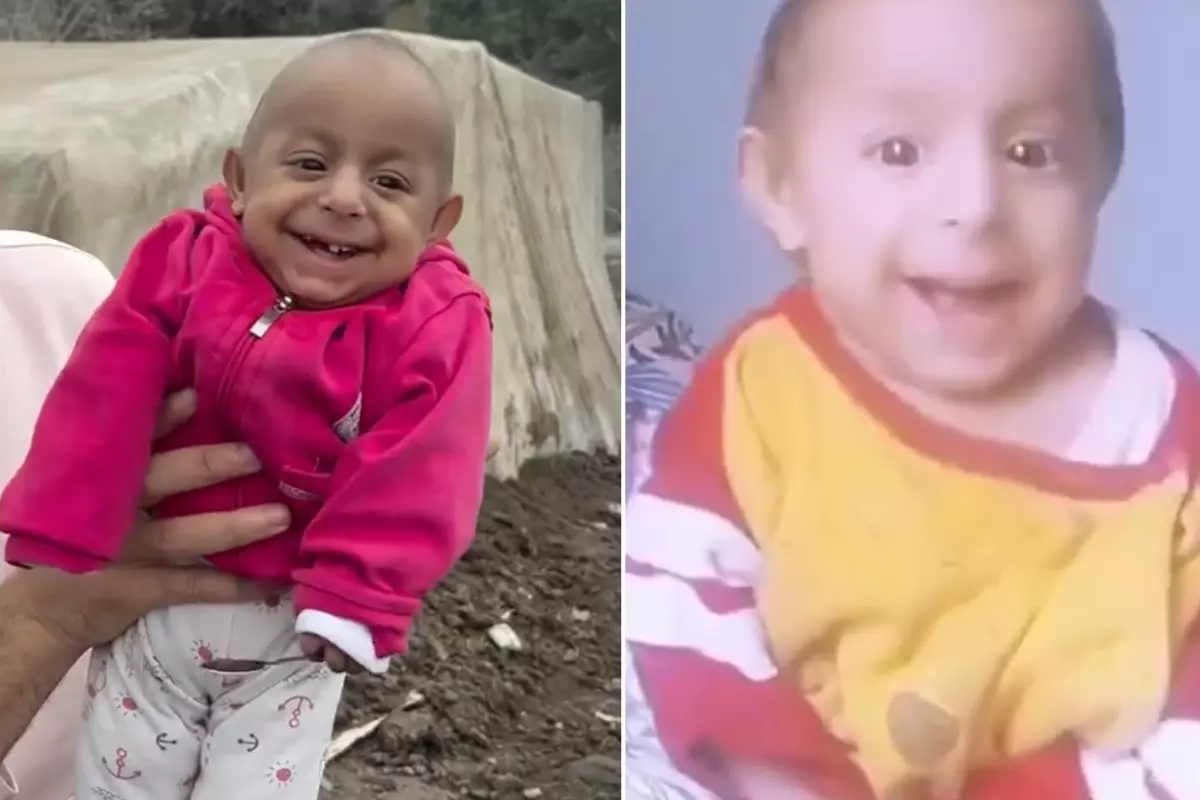 'Gülen Bebek' olarak tanınan Ökkeş Bebek hayatını kaybetti