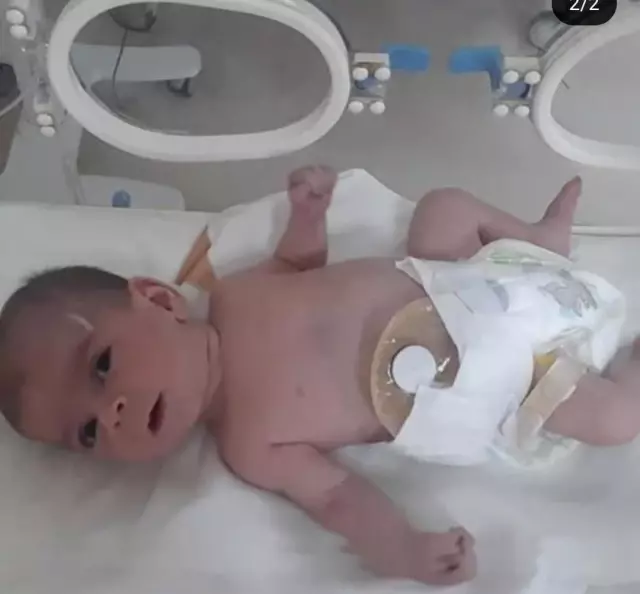 They said it was fate, but the reality was completely different! Their daughter became disabled due to the heartless nurse.