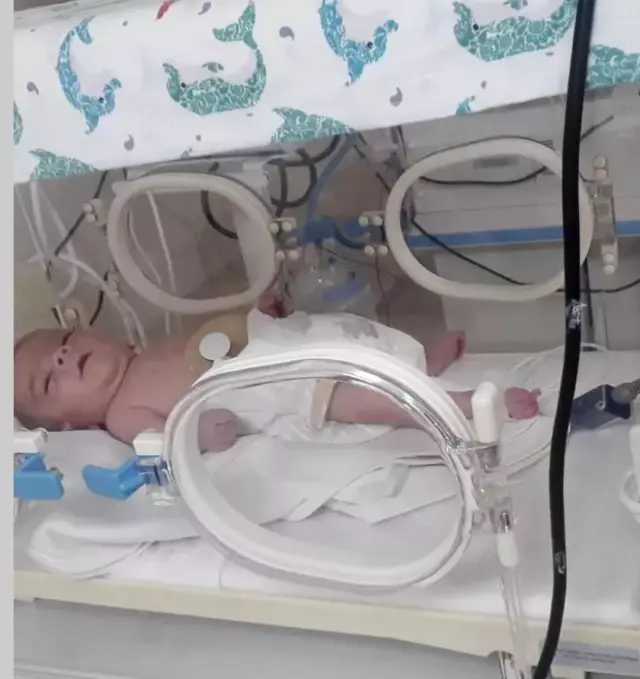They said it was fate, but the reality was completely different! Their daughter became disabled due to the heartless nurse.