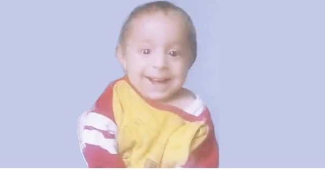 Ökkeş Bebek öldü mü, yaşıyor mu? SON DAKİKA! Ökkeş Bebek (gülen bebek) neden öldü?