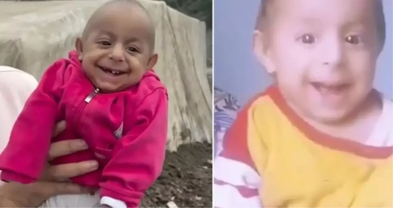 Ökkeş Bebek öldü mü, yaşıyor mu? SON DAKİKA! Ökkeş Bebek (gülen bebek) neden öldü?