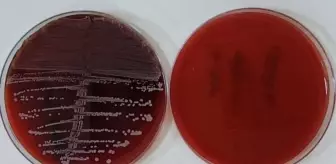 Karabük Üniversitesi'nden Enfeksiyon Riskini Azaltan Yenilikçi Implant Yöntemi