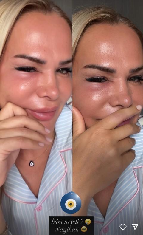Survivor star Nagihan Karadere seems to have been cursed: Look at my condition