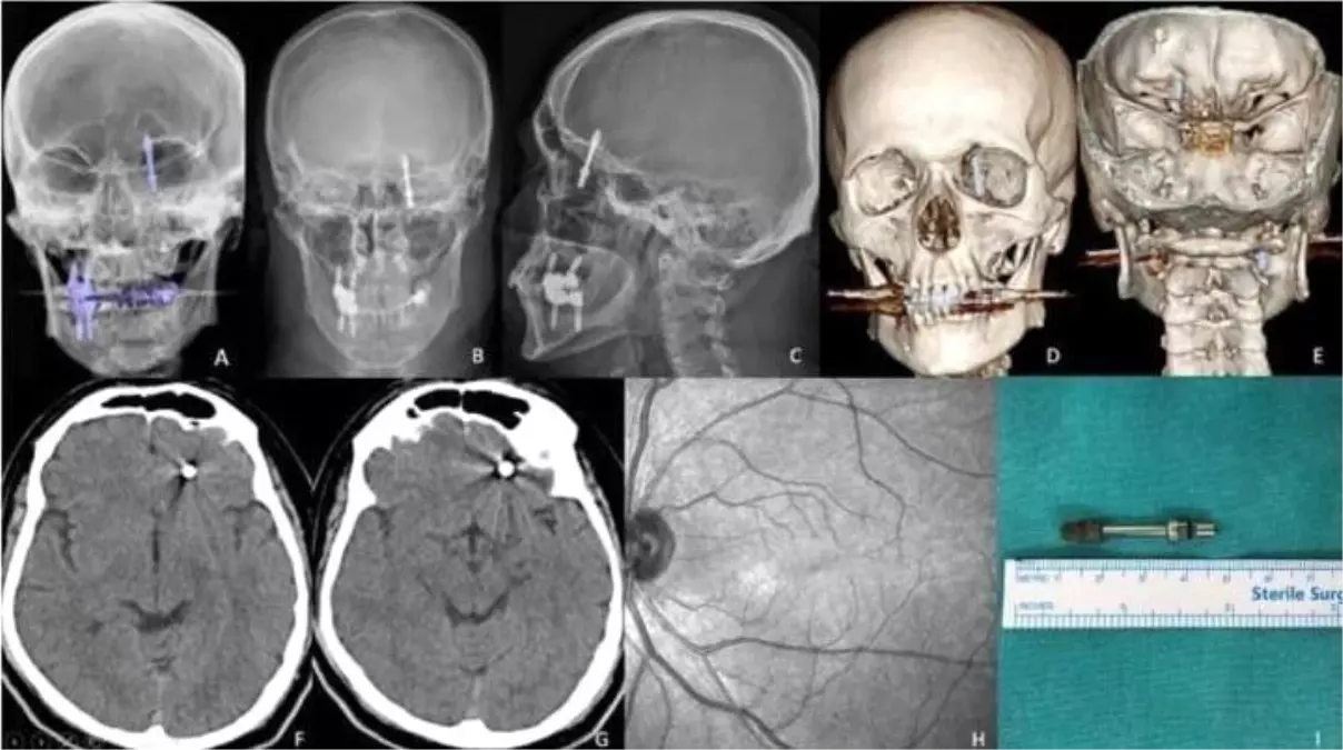 Diş Tedavisi Kabusa Dönüştü: İki Yıldır Adalet Bekliyor