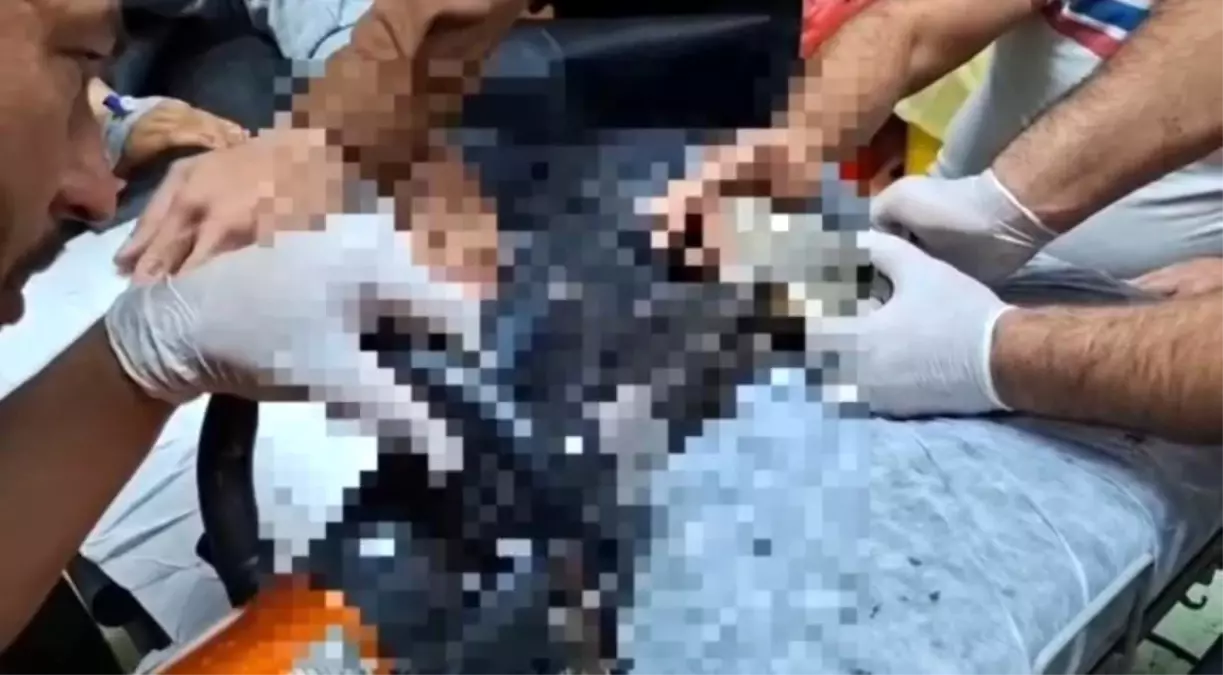 Suriye'de Kıyma Makinesine Kapanan 8 Yaşındaki Çocuk Kurtarıldı