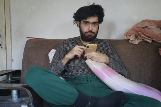 Barış's illness was revealed after taking a shower and getting a haircut 3 years later