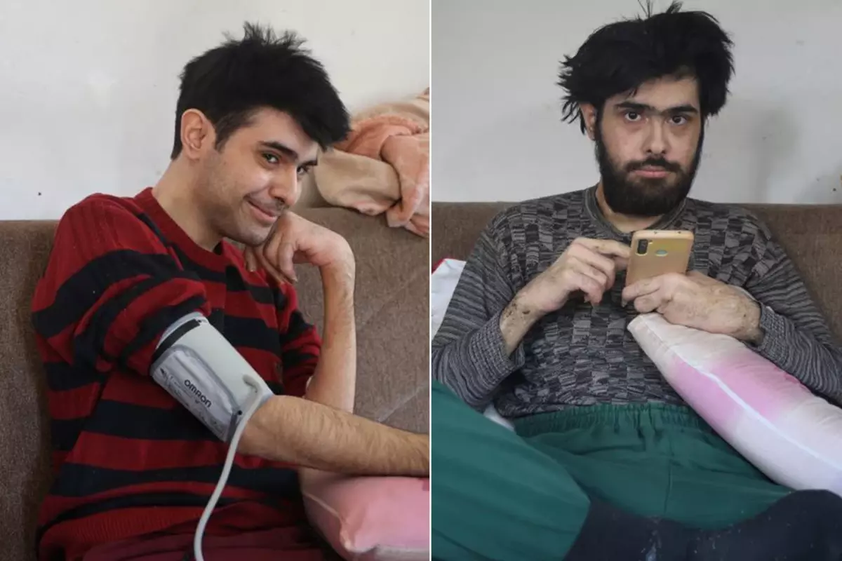 3 yıl sonra duş alıp tıraş olan Barış'a teşhis koyuldu