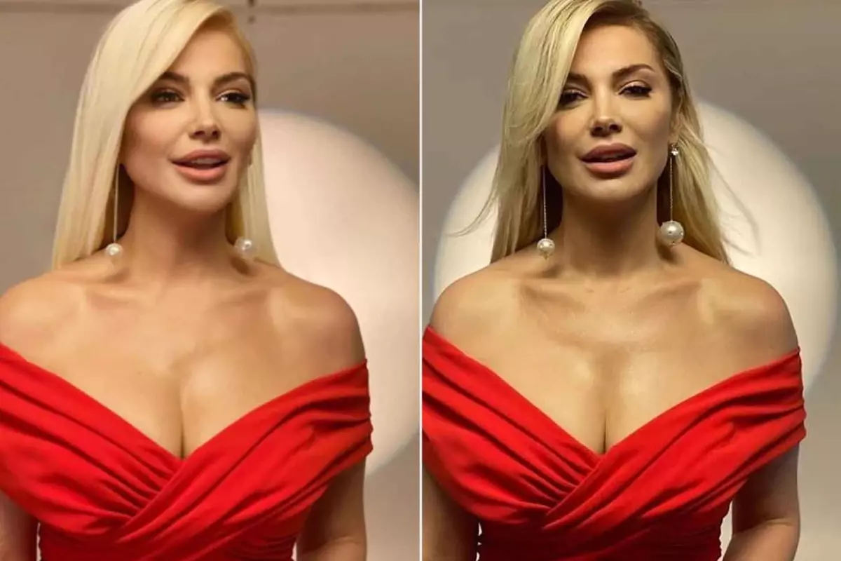 Estetik İddiaları Bitmiyor! Songül Karlı'nın son hali sevenlerini şaşırttı