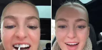 Dişlerini beyazlatmak için yaptığı akılalmaz!
