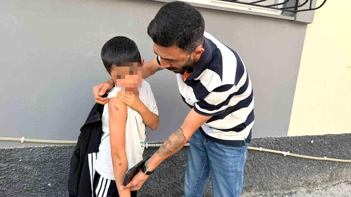 Adana'da Çocuğa Şiddet Uygulayan Şüpheli Tutuklandı