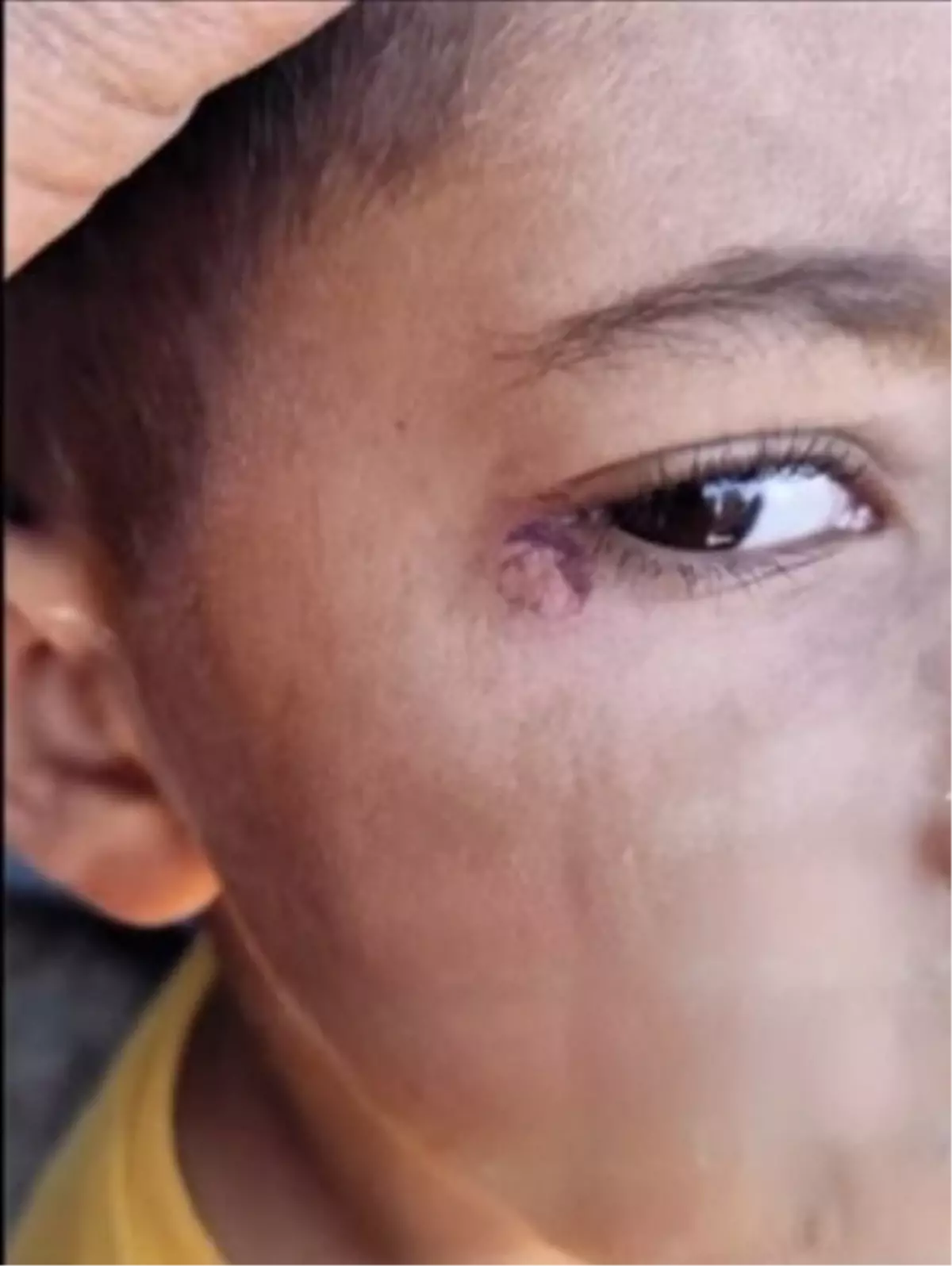 Çocuğun Yüzünde Sigara Söndüren Temizlik Görevlisi Tutuklandı