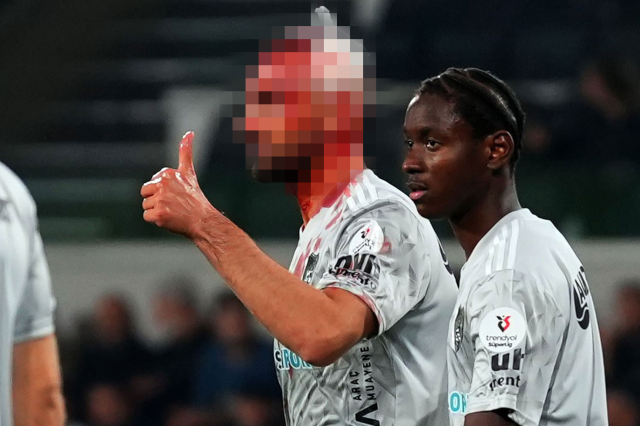 super lig de korkutan sakatlik kafasi yarildi 19207325 7754 m