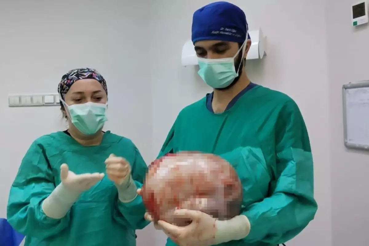 2 ayda 9 aylık hamile gibi büyüdü, doktorlar görünce apar topar ameliyata aldı