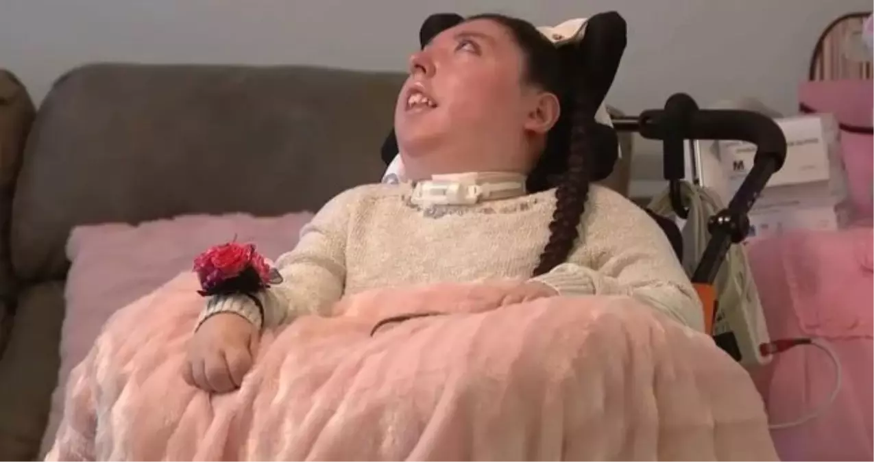 Beyinsiz doğan Alex Simpson kimdir? Alex Simpson kaç yaşında, nereli?