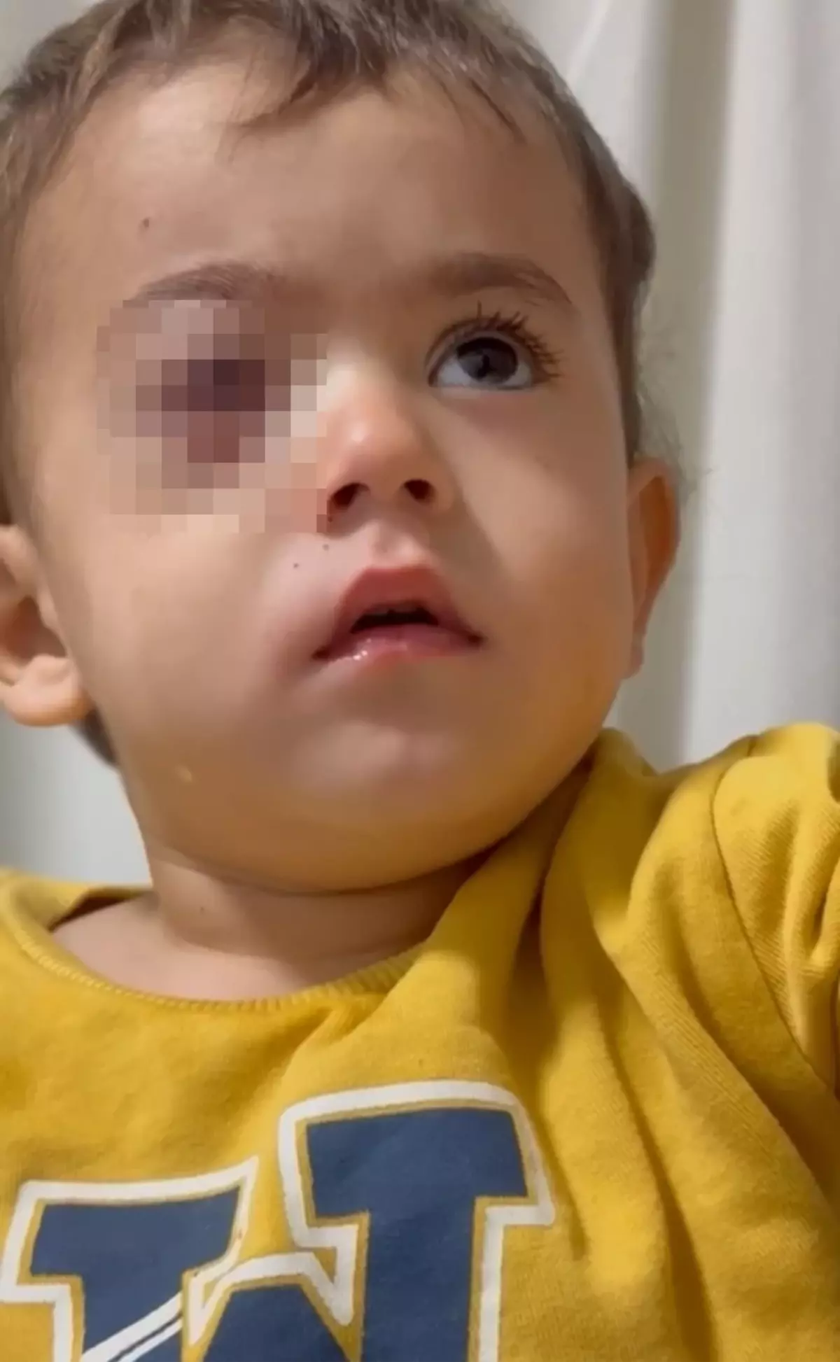 Çocukların Gözünü Kaybetmesine Neden Olan Torpil Fırından Alındı