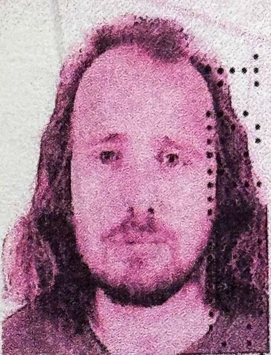 sac ektirip dis yaptiran ingiliz aniden 19249739 3671 m