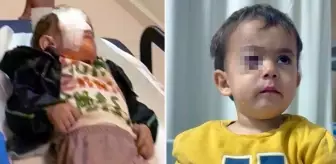 Torpil küçük çocuğun gözünü kör etti, babası kahreden gerçeği açıkladı