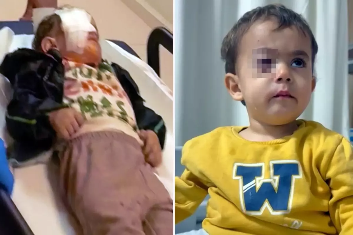 Torpil küçük çocuğun gözünü kör etti, babası kahreden gerçeği açıkladı