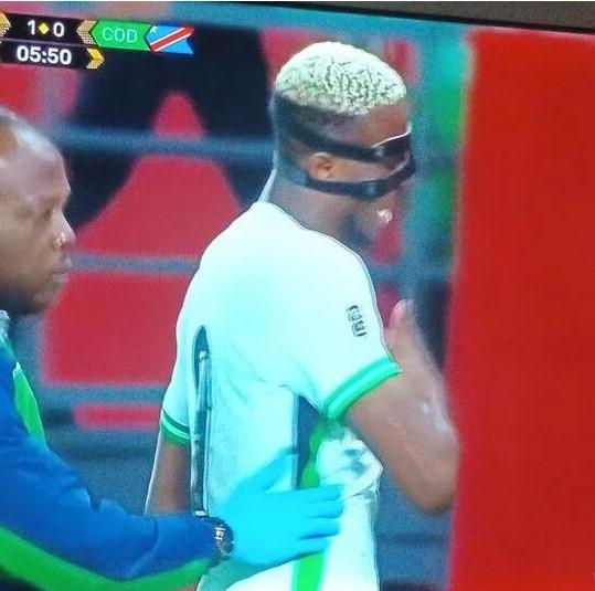 nijerya demokratik kongo macinda sakatlanan 19260091 2308 m