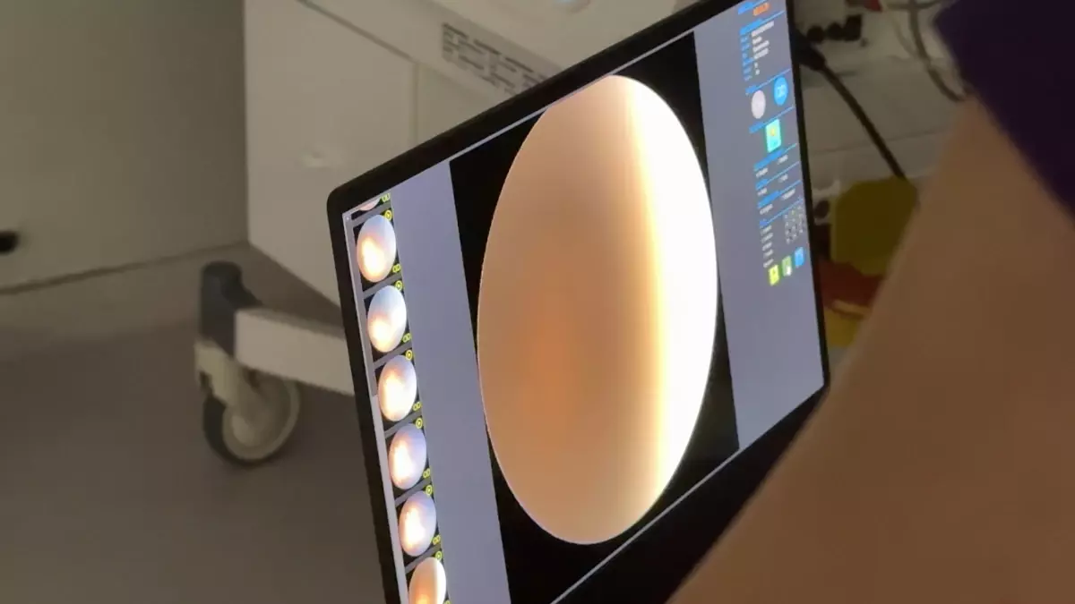 Rize'de 'prematüre retinopatisi' tanı ve tedavisi yapılabilecek