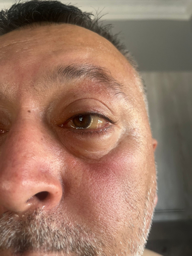 Yunanistan'dan Türk tatilcilere skandal muamele 5 yunanistan da turk tatilcilere skandal muamele 19260511 9485 m