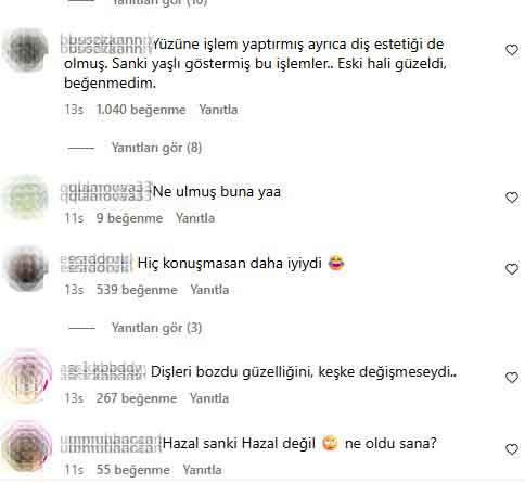 hazal kaya nin son goruntusu sevenlerini sasirtti 19268075 5460 m