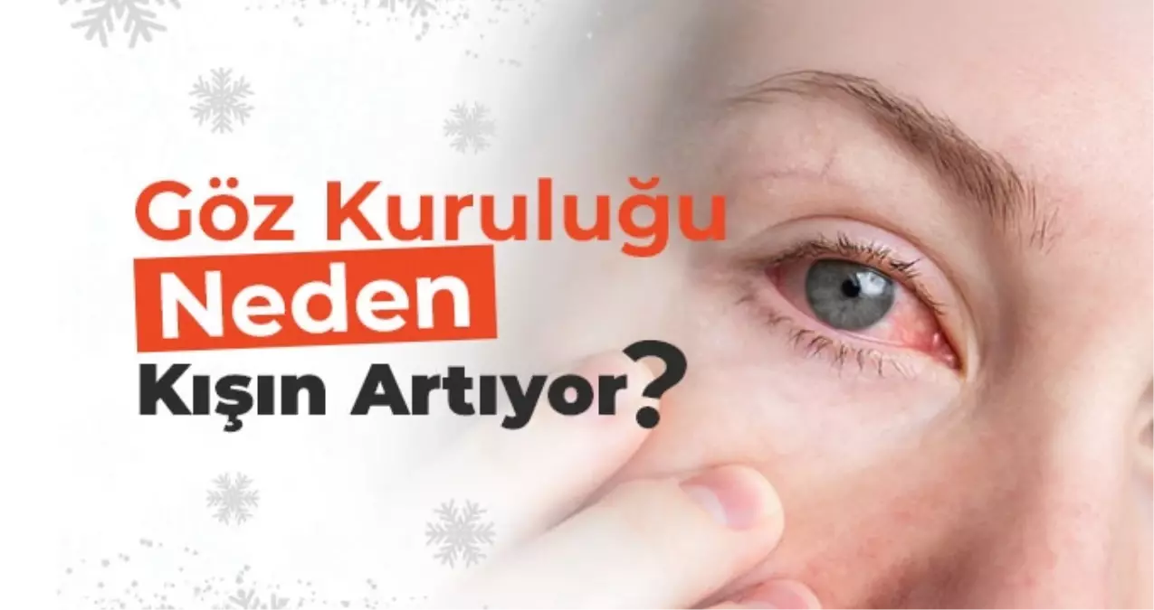 Op. Dr. Özer Kavalcıoğlu Göz Kuruluğu İle İlgili Merak Edilenleri Açıklıyor