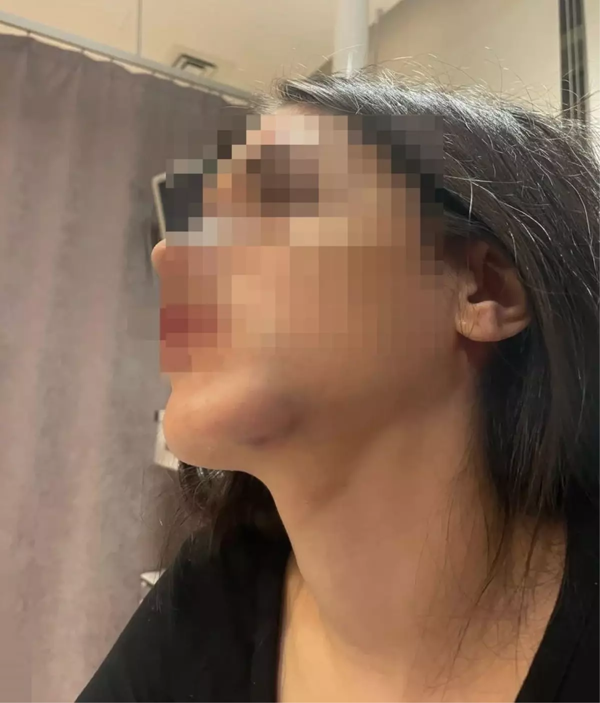 Samsun'da Kavga: Eski Aşklar Arasında Şiddet Olayı