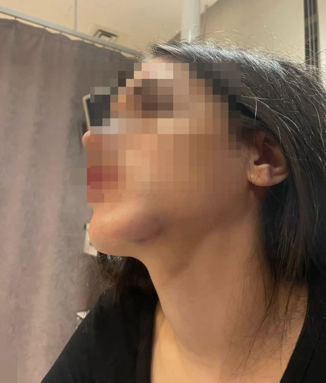 Young woman was brutally beaten! 'She trapped me' and shared her photos