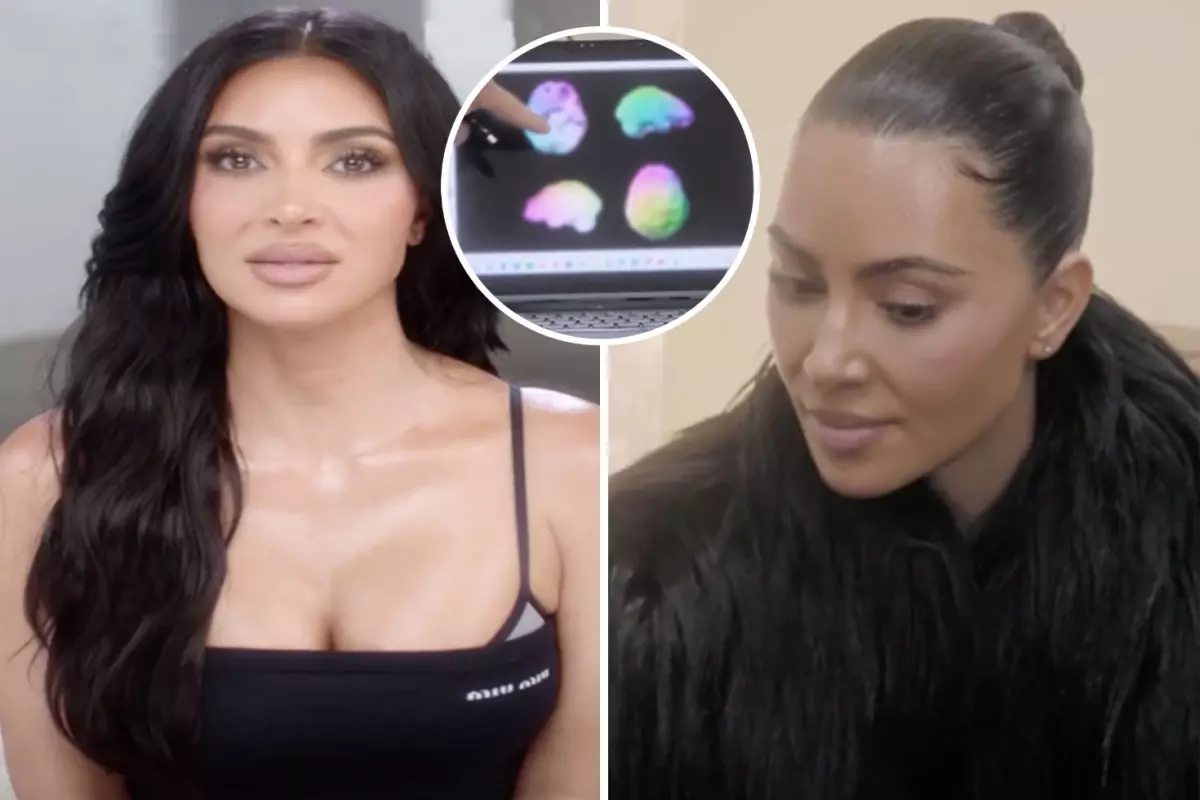 Kim Kardashian'ın beyin taramasından 'düşük aktivite' çıktı